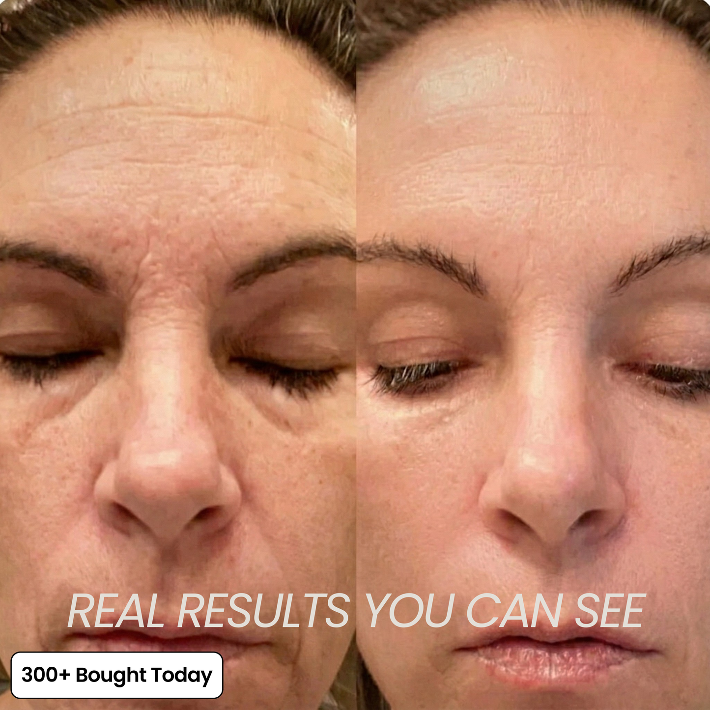 Tired of Fine Lines & Hollows? Passingta Calcium Multi Balm Smooths & Plumps Skin Instantly