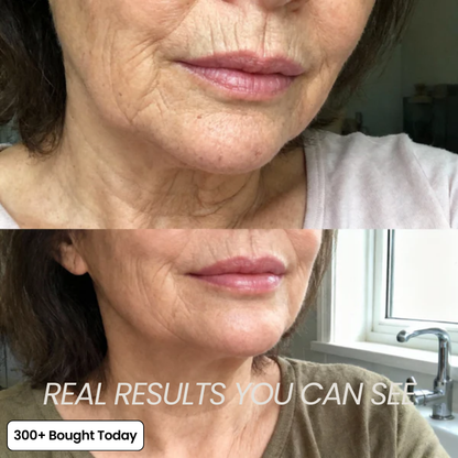 Tired of Fine Lines & Hollows? Passingta Calcium Multi Balm Smooths & Plumps Skin Instantly